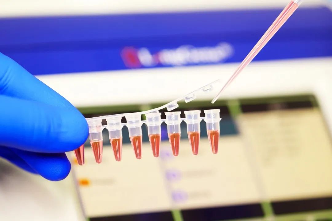 Hoe om PCR/qPCR-verbruiksgoedere te kies?